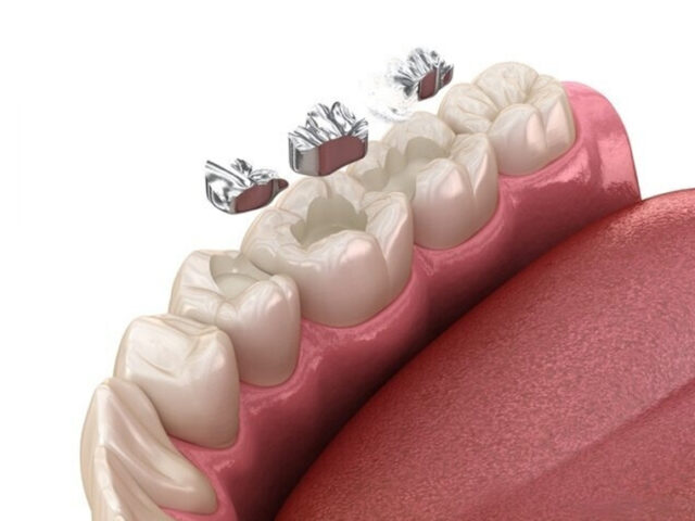 https://www.indudental.in/wp-content/uploads/2023/09/20-640x480.jpg